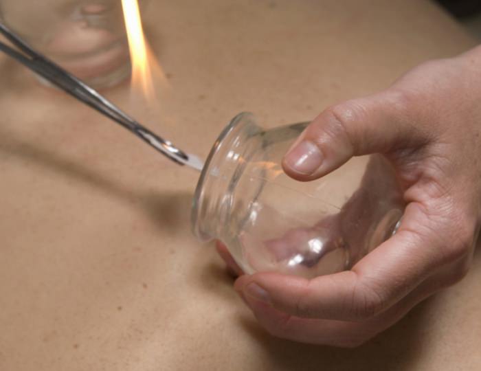 Вакуум-терапия - Санаторий «Буг» Беларусь